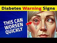 Video thumbnail for 7 Signs Your Eyes Tell You About Diabetes!