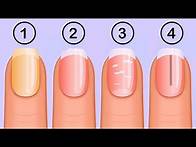Video thumbnail for Types of nail color and health problems associated with them - Credihealth