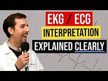 Video thumbnail for ECG Interpretation Made Easy - How to Read a 12 Lead EKG Systematically!