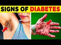 Video thumbnail for 20 SIGNS that YOU HAVE DIABETES without KNOWING | 95