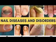 Video thumbnail for NAIL DISEASES AND DISORDERS