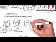 Video thumbnail for Colorectal Cancer - Overview