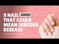 Video thumbnail for 9 Nail Changes That Could Mean Serious Disease❗️/ 9 Nail Signs Of Health Problems ✅