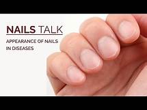 Video thumbnail for How Do Nails Help in Diagnosing Systemic Disease ? Nail Abnormalities in Systemic Diseases