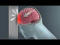 Video thumbnail for How Traumatic Brain Injury (TBI) Affects Brain Cells - New Research Could Lead to New Treatments