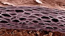 Video thumbnail for Disease, defence and treatment – WJEC - GCSE Biology (Single Science) - WJEC - Video - BBC Bitesize