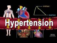 Video thumbnail for Hypertension - High Blood Pressure, Animation