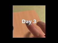 Video thumbnail for 100 Days Smashed Finger Nail Recovery Process