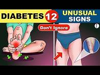 Video thumbnail for 12 Unusual Symptoms of Diabetes | Diabetes Symptoms | Diabetes Mellitus | | Diabetes Warning Signs