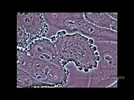 Video thumbnail for Mitosis in an animal cell Under the Microscope