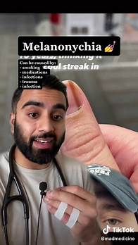Video thumbnail for And now you know #skincancer #cancertok #cancer #melanoma #melanomaawareness #tiktokdoctor #medicalfact #humanbodyfact #ByeByeSundayBlues