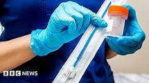 Video thumbnail for Cervical cancer: Northern Ireland adopts new HPV screening programme