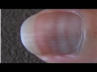 Video thumbnail for BE CAREFUL ABOUT THESE NAILS- Mees Lines