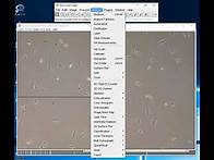 Video thumbnail for Cell counting and scale bars using ImageJ