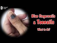 Video thumbnail for Bluish discoloration of nails. What does it mean? Dr. Rajdeep Mysore