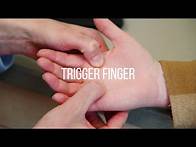 Video thumbnail for Trigger Finger Symptoms, Causes, and Treatment