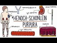 Video thumbnail for Henoch-Schonlein Purpura: Visual Explanation for Students