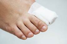 Video thumbnail for Common Toenail Problem Symptoms, Causes, and Treatment