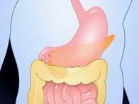 Video thumbnail for Diabetes Basics: What Is Diabetes?