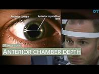 Video thumbnail for OT skills guide: Anterior chamber depth