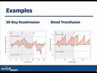 Video thumbnail for Monitoring Quality with CUSUMs