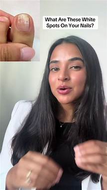 Video thumbnail for Understanding Keratin Granulations on Your Nails
