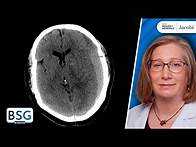 Video thumbnail for Traumatic Brain Injury Management | Neurosurgery Course | March 2, 2023