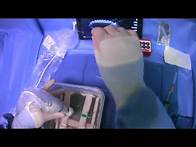 Video thumbnail for How To Use The Micropuncture Kit