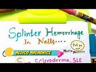 Video thumbnail for Mnemonic For Causes of Splinter fingernail,Splinter Hemorrhages, For NEET-PG,USMLE Step 1 Prep