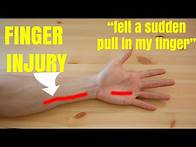 Video thumbnail for Finger injury FIXED in 4 minutes!! and WHAT IS IT? | Expert advice from Physiotherapist