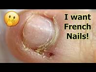 Video thumbnail for Short & bitten Nails Transformation to French Manicure