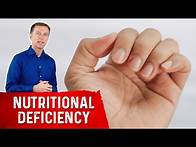 Video thumbnail for Your Nails Help Diagnose Nutrient Deficiencies