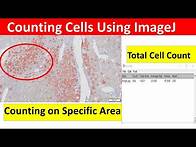 Video thumbnail for How to Count Cells Using ImageJ | How to Count Cells in Imagej | Imagej Cell Counting |