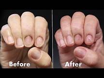 Video thumbnail for How To Fix DAMAGED, THIN & BRITTLE NAILS!!! ***NATURAL NAIL STRENGTHENING TREATMENT***