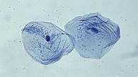 Video thumbnail for What are cells? - Cell structure - National 5 Biology Revision - BBC Bitesize