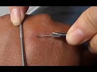 Video thumbnail for Splinter Removal Video - Nails in hand