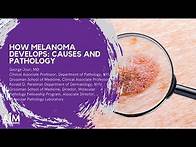 Video thumbnail for How Melanoma Develops: Causes and Pathology