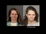 Video thumbnail for Street Drugs - Faces of Meth (Disturbing Depictions of Drugs)