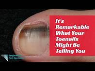 Video thumbnail for It's Remarkable What Your Toenails Might Be Telling You