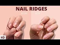 Video thumbnail for Nail Ridges: The Silent Signaling Your Nails Are Trying to Tell You