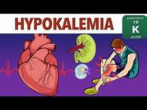 Video thumbnail for Hypokalemia -causes - diagnosis - management -prevention