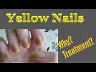Video thumbnail for Yellowing of the nails: Causes & treatment