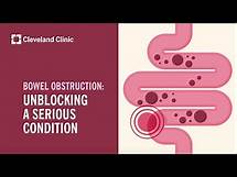 Video thumbnail for Bowel Obstruction: Unblocking A Serious Condition