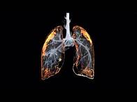 Video thumbnail for Understanding the risks of mixing drugs (:60)