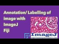 Video thumbnail for Annotation in imageJ | How to add arrow to ImageJ | Labelling in imageJ | Arrow Annotation