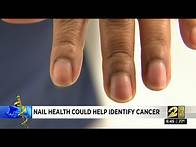 Video thumbnail for Nail health could help identify cancer