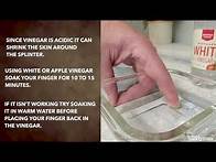Video thumbnail for Home Remedies to Remove a Splinter