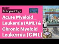 Video thumbnail for Acute Myeloid Leukemia (AML) & Chronic Myeloid Leukemia (CML) (Pathophysiology) | Sketchy Medical