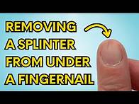 Video thumbnail for My Simple Trick to Instantly Remove a Splinter From Under Your Fingernail (watch until the end!)