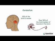 Video thumbnail for What is Dandy Walker Syndrome?